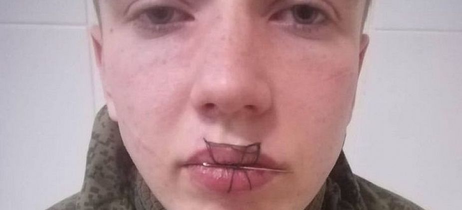 Солдат-срочник из Североуральска после ссоры с девушкой зашил себе рот 