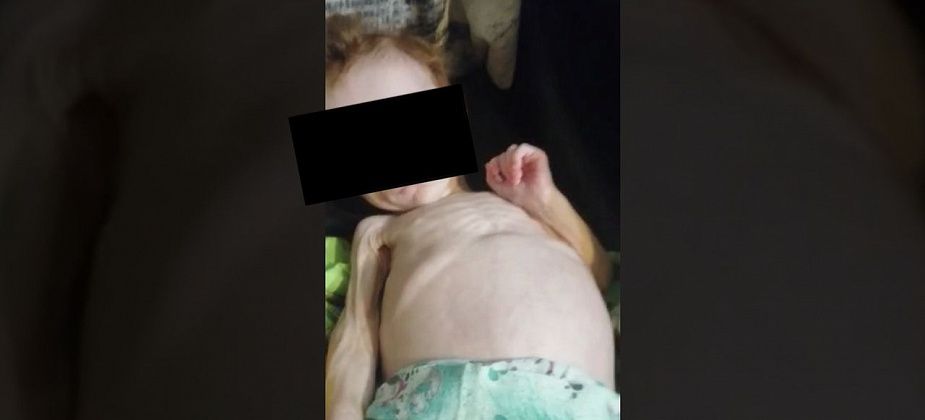 Девочка из Карпинска, которую мать держала в шкафу, переведена из реанимации в обычную палату